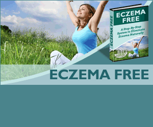 Ezcema Free
