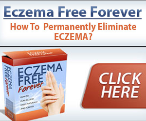 Ezcema Free Forever
