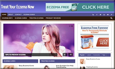 Treat Your Eczema