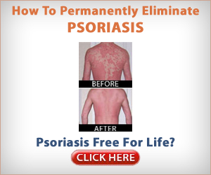 Psoriasis Free for Life