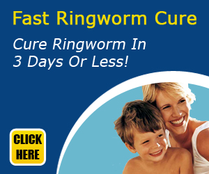 Fast Ringworm Cure