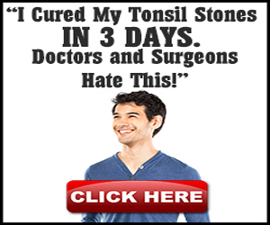 Fast Tonsil Stones Cure
